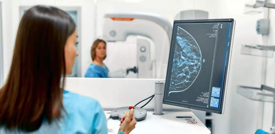 ENSAYO DE DIETA PERSONALIZADA EN CANCER MAMARIO